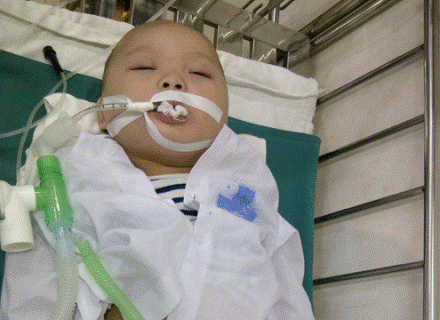Bé Tú đang được điều trị tại Bệnh viện Nhi Nghệ An (ảnh VNN).
