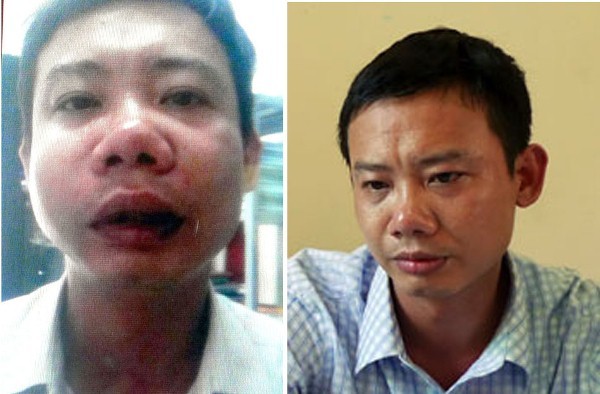 Vụ Văn Giang: Không chỉ có dân phòng hành hung nhà báo ảnh 10