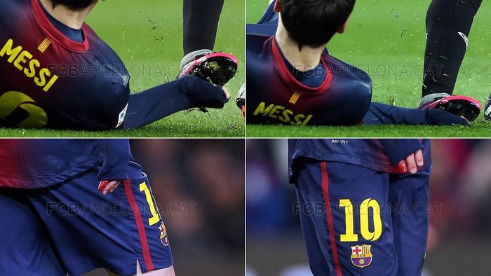 Do tình huống diễn ra khá nhanh và Jesus Navas cũng không cố ý nên đã không bị trọng tài rút thẻ, sau đó Messi đã phải mang găng tay bảo vệ để tiếp tục thi đấu.