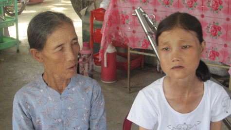 Cô gái Nguyễn Thị Như Ý (sinh ngày 16-7-1987, trú tại thôn Na Kham, xã Điện Quang) bị "hóa bà lão" từ năm lớp 8.