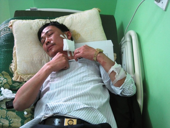 Ông Lê Vũ Hạnh, Trưởng công an xã Hải Ninh đang điều trị tại bệnh viện Đa Khoa Hợp Lực Thanh Hóa