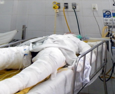 Chị Yến tử vong do bỏng lửa xăng 95% cơ thể - Ảnh: Nguyễn Tú