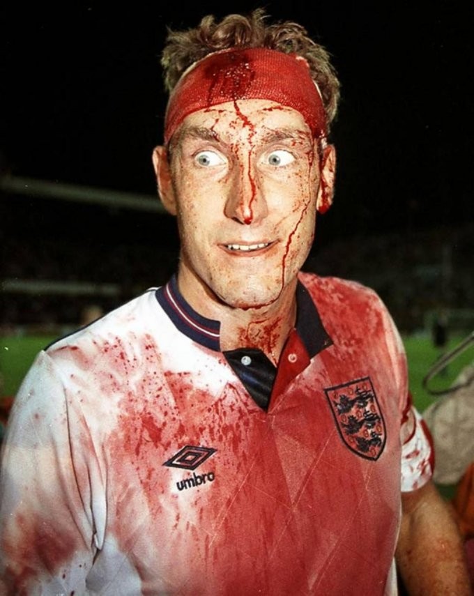 Đây là huyền thoại Terry Butcher, cựu đội trưởng lừng danh một thời tuyển Anh. Hình ảnh về Butcher cho thấy trận đấu giữa Anh - Thụy Điển năm 1989 diễn ra căng thẳng như thế nào.