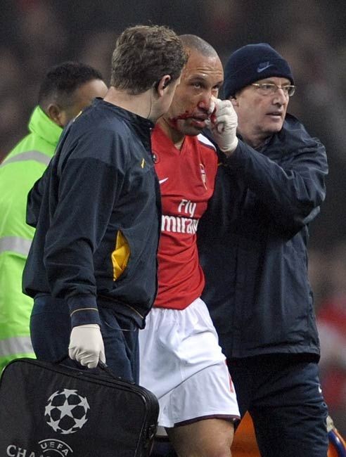 Khi mới chuyển tới Arsenal từ MU năm 2008 thì lão tướng Silvestre đã nhanh chóng tạo dấu ấn với pha chấn thương mũi mất rất nhiều máu trong trận Arsenal hoà không bàn thắng trước Fenerbahce trong khuôn khổ Champions League.