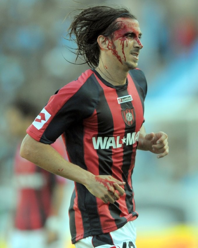 Khuôn mặt đầy máu của cầu thủ Santiago Hirsig (San Lorenzo).