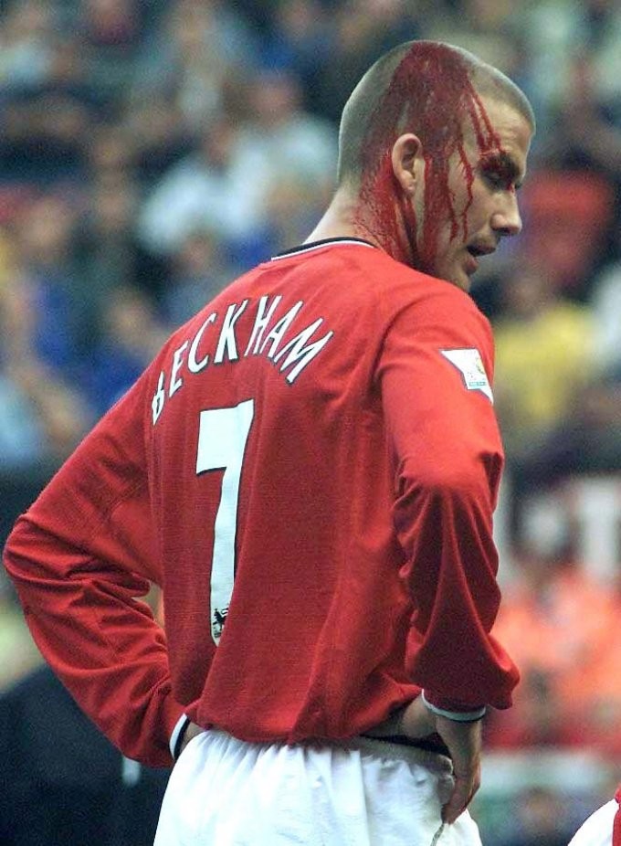 Beckham cũng từng phải đổ máu khi còn khoác áo MU.