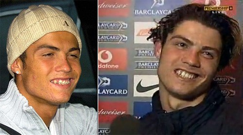 Khi xưa, trông C. Ronaldo thật xấu trai khi nở nụ cười.