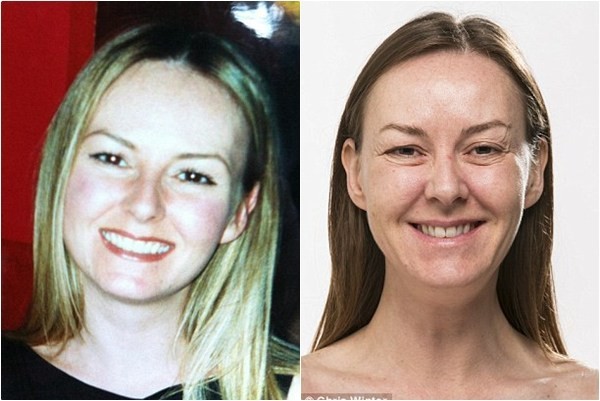 Karen Cross hiện tại (phải) hy vọng sẽ lấy lại được vẻ trẻ trung cách đây 10 năm (ảnh trái) nhờ thẩm mỹ.