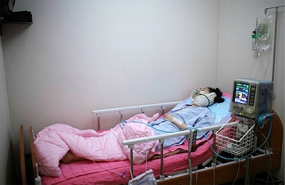 Cô gái đã phải nằm bẹp trên giường sau khi làm phẫu thuật