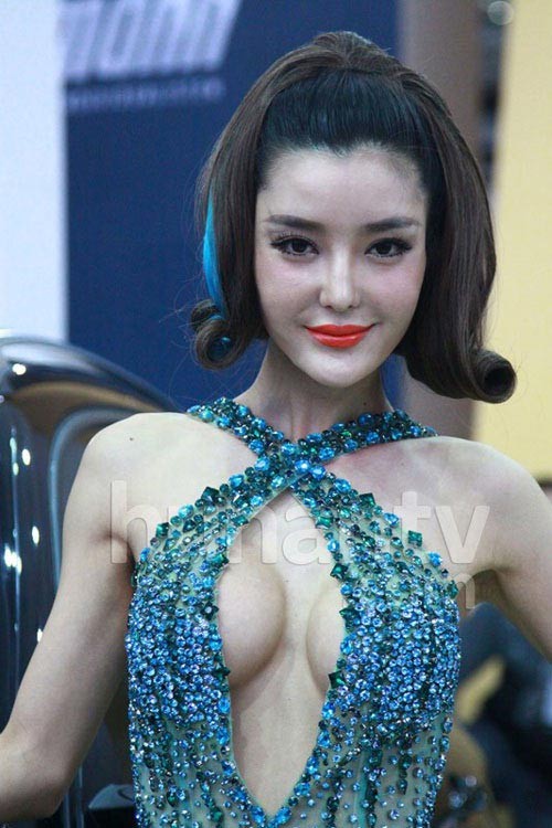 Nhiều ý kiến cho rằng hot girl Trung Quốc đã lạm dụng chất làm đầy khiến gương mặt biến dạng.