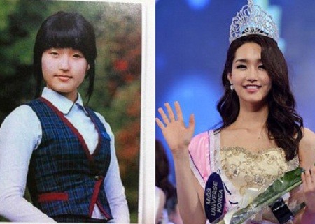 Hoa hậu Hàn Quốc 2012 Kim Yu Mi trước và sau khi phẫu thuật thẩm mỹ