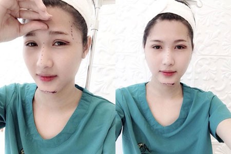 Nguyễn Văn Hiếu từng gây xôn xao cộng đồng mạng khi công khai ảnh phẫu thuật thẩm mỹ chuyển giới thành hot girl.