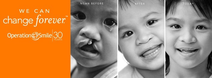 Operation Smile đã làm thay đổi cuộc đời các em sang một trang hoàn toàn mới