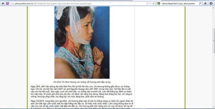 Chuyên mục Thời sự- xã hội ngày 30/5/2012 đăng tin “Bị chồng đánh chảy máu đầu, phải khâu sáu mũi” với hình ảnh máu me phản cảm