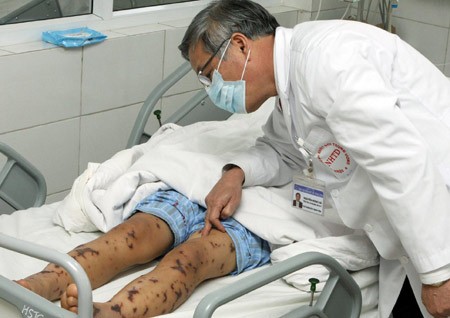 Hình ảnh bác sĩ Nguyễn Hồng Hà, Phó Giám đốc Bệnh viện Nhiệt đới Trung ương đang thăm khám bệnh nhân.