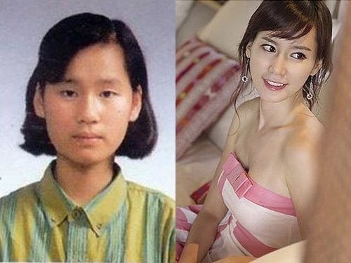 Hoa hậu Hàn Quốc 1999 Lee Hye Won nhờ phẫu thuật thẩm mỹ mới xinh đẹp được như tấm hình bên phải.