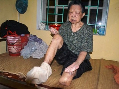 Cụ Vũ Thị Bớt (89 tuổi, xã Dũng Tiến, huyện Thường Tín, TP Hà Nội) chia sẻ với phóng viên