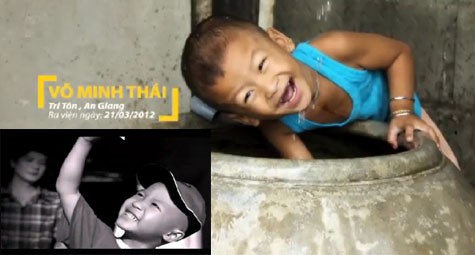 Hình ảnh cậu bé "diễn viên" Tuấn đã được thay thế bằng hình ảnh cậu bé bệnh nhân có thật, tên Thái. (Ảnh cắt từ clip).