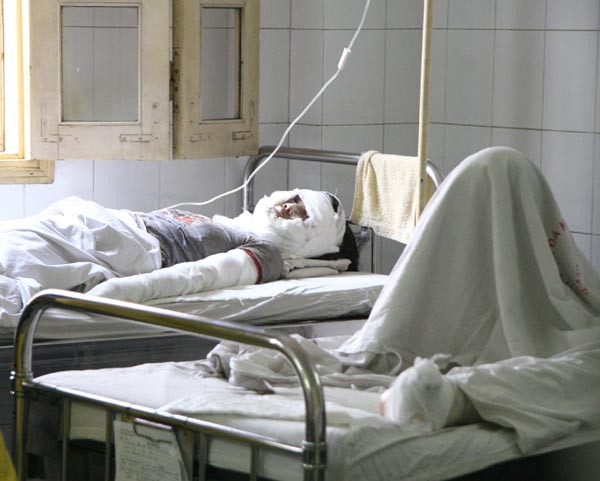Ngay tại khoa Bỏng Bệnh viện Xanh Pôn mỗi tháng cũng tiếp nhận vài chục bệnh nhân bỏng do nổ gas, vùng bỏng rộng và thường bị ở mặt, tay.