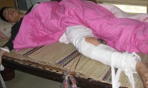 Khánh đang điều trị tại Bệnh viện đa khoa tỉnh Nghệ An