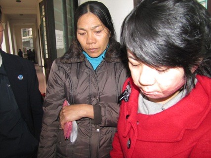 Nạn nhân Nguyễn Thị Thu Hiền cũng có mặt tại phiên tòa với những vết thương có lẽ không bào giờ lành lại được trước hành vi mất nhân tính của Đồng