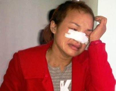 Chị Nguyễn Thị D đau đớn sau khi bị hành hung tập thể