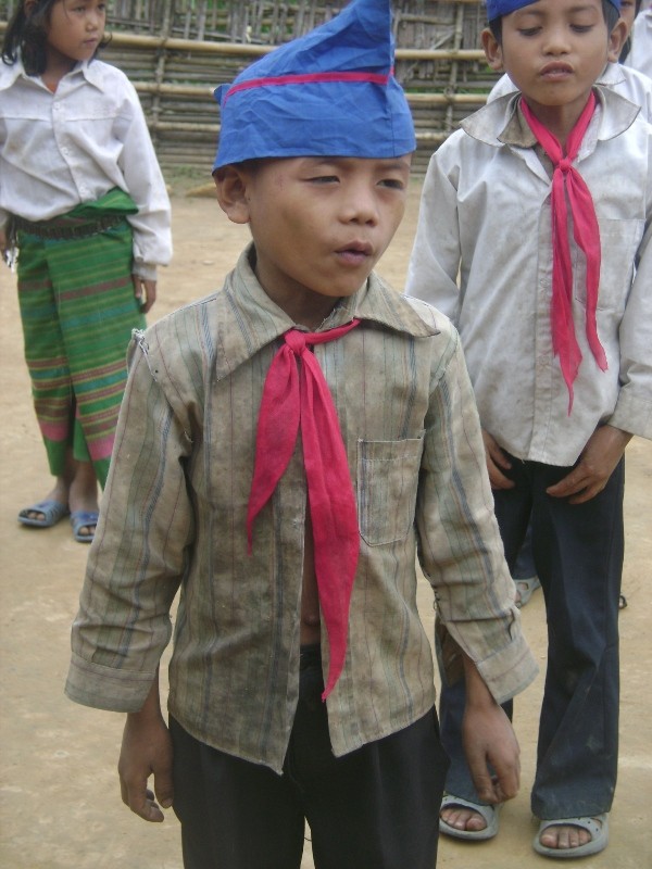 Cậu bé này đi học có mỗi bộ quần áo duy nhất nên mặc dù cúc áo đã mất gần hết nhưng vẫn phải mặc