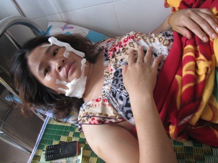 Chị Cúc đang điều trị tại bệnh viện với vết thương ở mặt và cổ