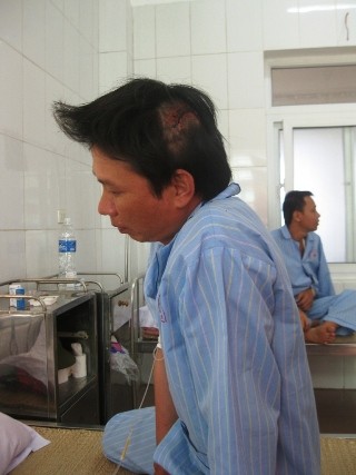 Anh Xoan đang nằm điều trị tại Bệnh viện 115 Nghệ An với nhiều vết chém và vết thương trên người.