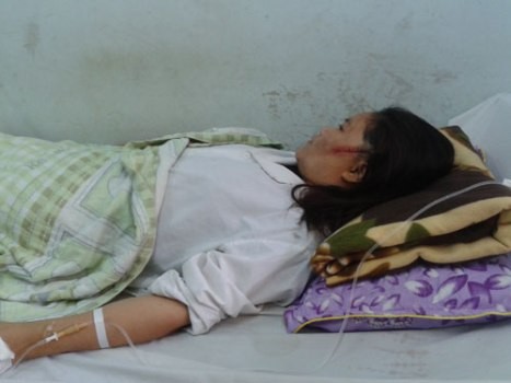 Chị Tâm đã bị bố chồng chém 3 nhát vào người hiện đang điều trị tại Bệnh viện Đa khoa Nghệ An
