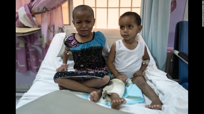 Hai trẻ em Yemen bị thương do các cuộc xung đột (Ảnh: Reuters)