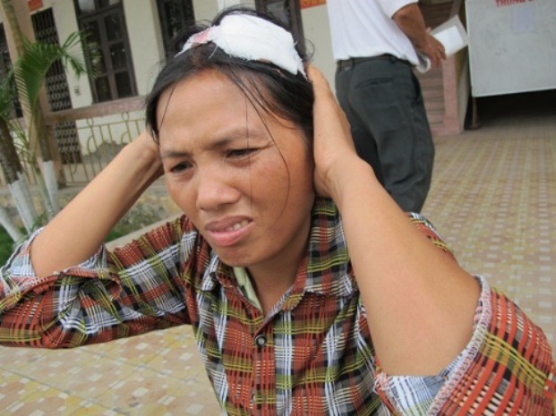Bà Lương Thị Dĩnh (người dân thôn Trâm Khê), một trong những người dân bị hành hung tại Tiên Lãng bị thương, phải khâu nhiều mũi trên đầu