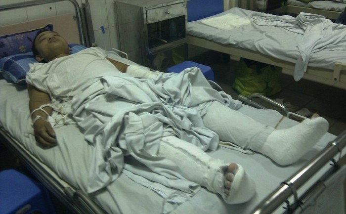 Vũ Hữu Huấn với nhiều vết thương nặng tại bệnh viện Việt Đức