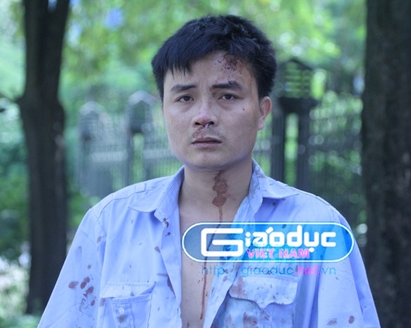 Anh Bùi Văn Thức, lái xe cho hãng taxi Thành Lợi bị đa chấn thương do hai người đàn ông mặc quần áo công vụ trong Siêu thị Big C Thăng Long hành hung (Ảnh Viết Cường)