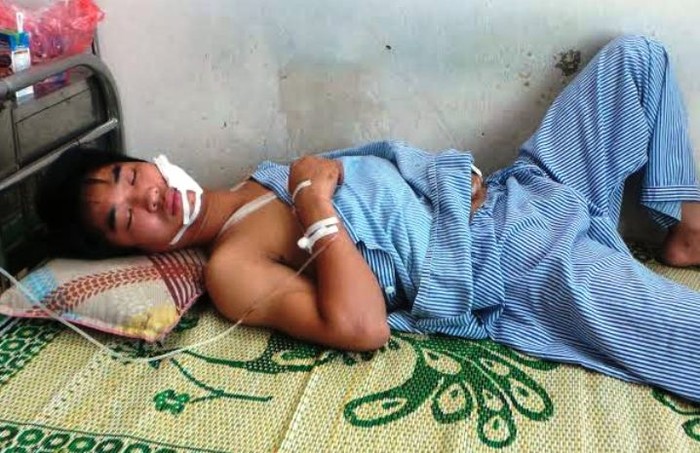 Đối tượng Nguyễn Văn Chính bị thương đang nằm điều trị tại bệnh viện