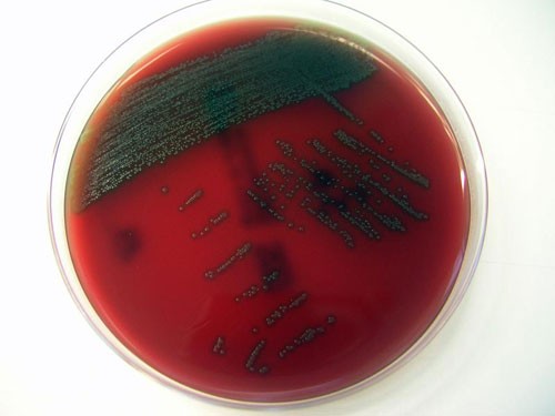 Vi khuẩn Streptococcus Tigurinus - Ảnh: IDW-online