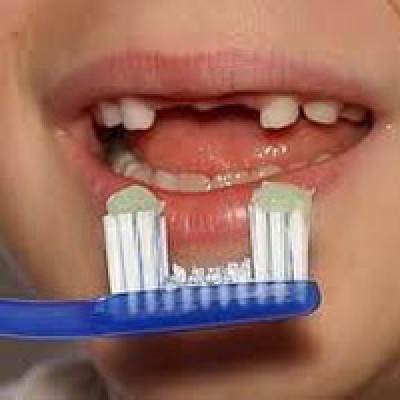 Về vệ sinh răng miệng, cần chải răng đúng cách với kem chứa fluor, tốt nhất là sau bữa ăn. Nếu chải 1 lần/ngày thì nên làm vào buổi tối trước khi đi ngủ. Lấy cao răng định kỳ 6 tháng/lần.