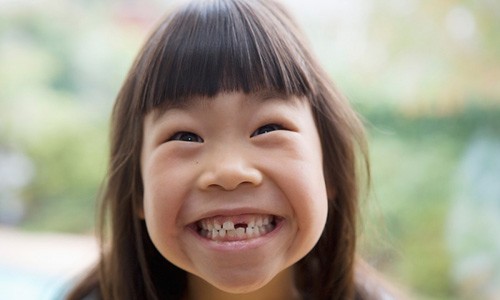 Khi trẻ ăn bất kỳ loại thực phẩm nào có chứa nhiều đường hoặc tinh bột cũng đều có thể gây sâu răng bằng cách các chất này hòa tan men bảo vệ răng của con bạn.