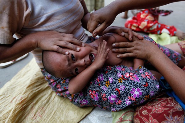 Một câu bé đang phải chịu cảnh đau đớn do điều trị bệnh sốt rét bằng phương pháp cổ truyền.