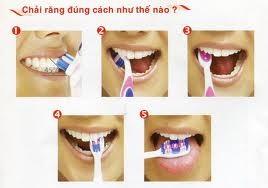 4. Chứng chảy máu chân răng: Nguyên nhân: Chăm sóc vệ sinh răng không tốt dẫn đến viêm lợi, đánh răng không đúng cách làm tổn thương lợi...