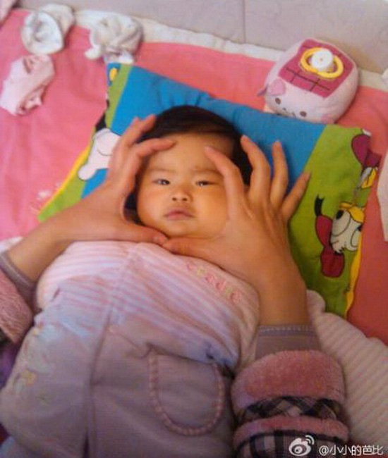 Mẹ Tiểu Miễn thường xuyên đăng tải ảnh của bé lên mạng. Đôi khi, cô khéo léo che phần mặt có u cho con gái. Xem thêm: Hình ảnh về những căn bệnh quái dị nhất trên thế giới (P4) / Hình ảnh về những căn bệnh quái dị nhất trên thế giới (P1)