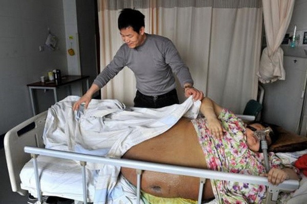 Cô Dương Lệ Quyên đã mắc bệnh lạ suốt 12 năm nhưng vì gia đình kinh tế khó khăn nên vẫn chưa có cơ hội chữa trị tại các bệnh viện lớn.