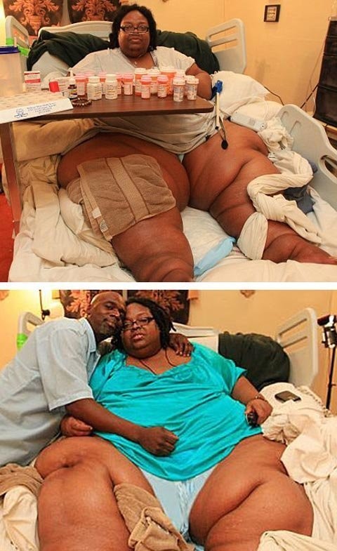 9. Terri Smith: Người phụ nữ lập kỷ lục béo nhất thế giới năm 2010 với cân nặng 317,5kg đang đối mặt với cuộc chiến giảm cân cam go sau khi các bác sĩ tiết lộ cô có thể chết. Terri Smith bị trói buộc trong phòng ngủ tại nhà riêng ở bang Ohio, Mỹ, không thể cử động, đứng hay tự lăn mình. Cô hiện sống nhờ vào sự hỗ trợ hoàn toàn của chồng – Myron, 44 tuổi và cô con gái đầu - Najah, 30 tuổi. Xem thêm: Lạ lùng người phụ nữ khóc ra 'kim cương' / Trẻ béo phì dễ mắc ung thư gan khi trưởng thành / Bệnh lạ: Cô gái sau hôn mê bỗng trở thành... người đồng tính
