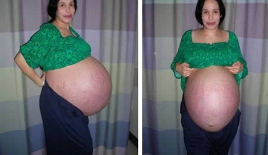 Cô Nadya Suleman khi mang bầu.