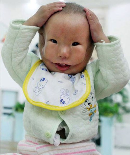 Kangkang: Em bé Trung Quốc này có đến 2 khuôn mặt. Xem thêm: Những loại quả cực tốt cho việc thanh nhiệt, giải độc mùa hè.