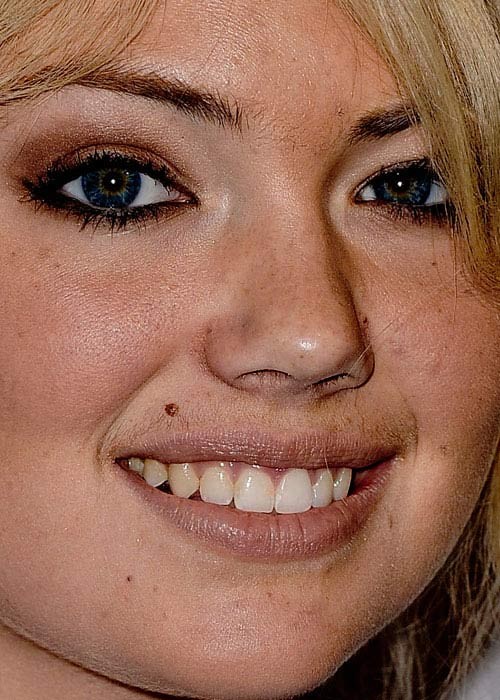 Kate Upton không chỉ để lộ những nốt ruồi "vô duyên" trên khuân mặt, mà có có thể nhìn rất rõ ria mép của cô Xem thêm:Cận cảnh: mặc mộc xinh xắn của Katy Perry