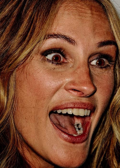 Julia Roberts không chỉ để lộ những nếp nhăn nơi khóe mắt mà còn để lộ cả những chiếc răng bị sâu Xem thêm:Cận cảnh: mặc mộc xinh xắn của Katy Perry