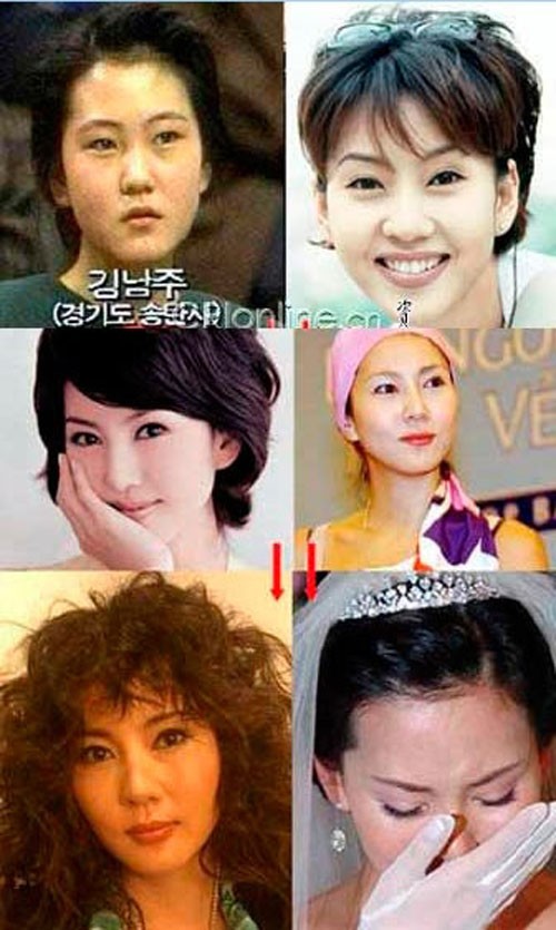 Nổi danh từ cuộc thi hoa hậu năm 1992, Kim Nam Joo từng bị xem là sản phẩm dao kéo. Hình ảnh cũ của cô khá lạ so với hiện tại. Xem thêm: Ngắm dàn Siêu Sao Hàn Quốc thanh tú, lịch lãm và phong cách