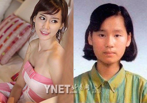 Hoa hậu Hàn Quốc năm 1999 Lee Hye Won nhờ phẫu thuật thẩm mỹ mới xinh đẹp. Xem thêm: Ngắm dàn Siêu Sao Hàn Quốc thanh tú, lịch lãm và phong cách