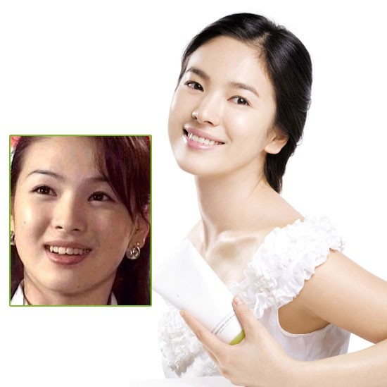 Song Hye Kyo trước khi đến nha sĩ cũng "khấp khểnh" như ai. Xem thêm:Môi xinh nồng nàn, quyến rũ như Sao Hàn trên tạp chí